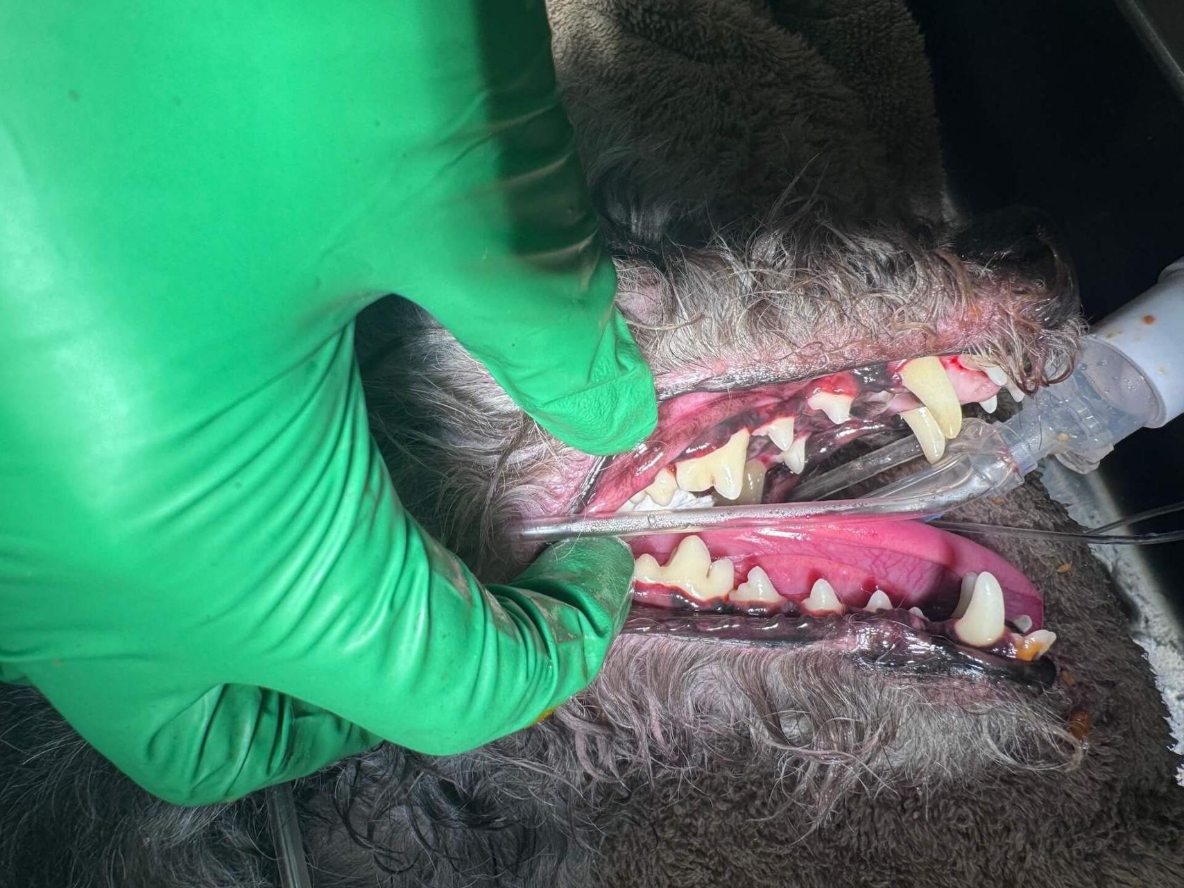 Dental Care After
